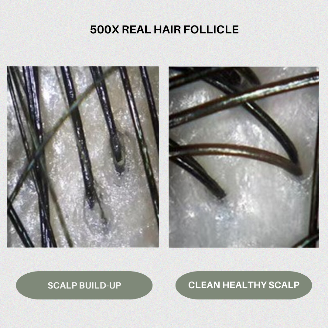 Head Detox: Charcoal & Chamomile Clarifying Shampoo