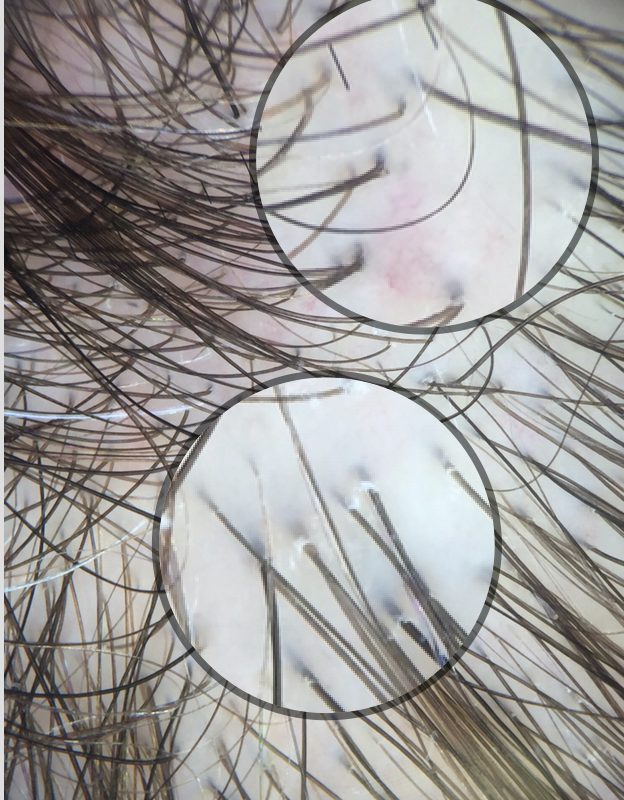hair and scalp spa