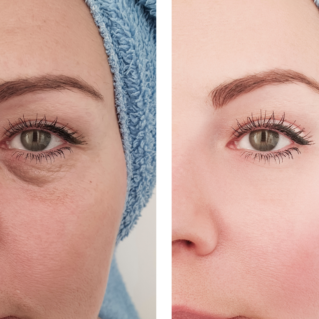 Face Minimizer: Pore Control Serum with 10% Niacinamide + 1% Zinc