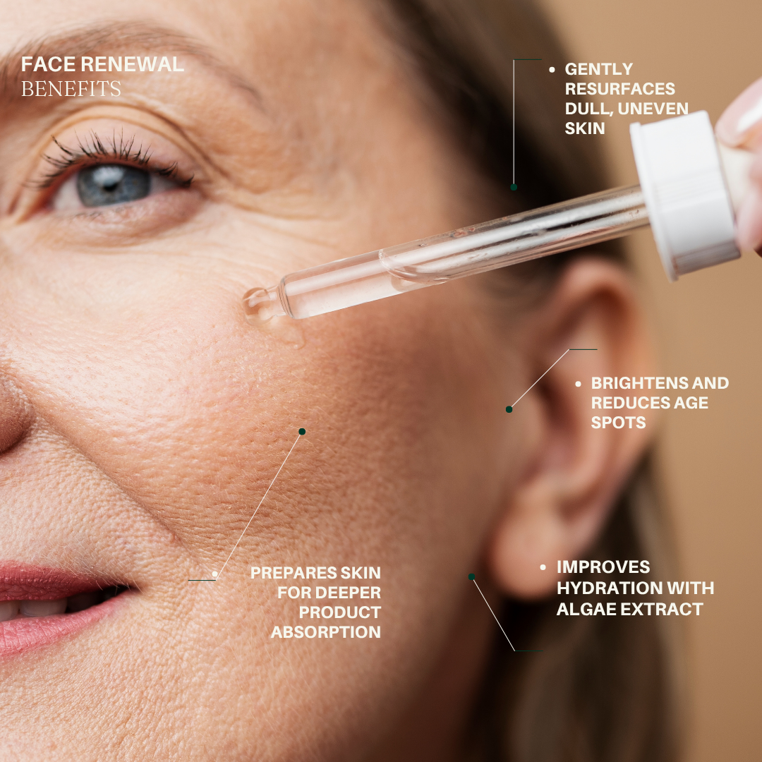 Face Renewal: 15% Lactic Acid Liquid Exfoliating Treament